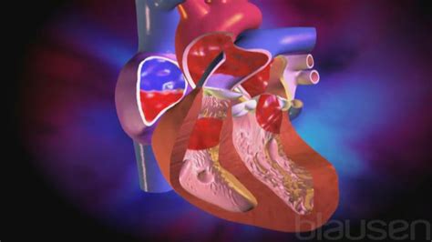 Overview of Heart Defects - Children's Health Issues - Merck Manual ...