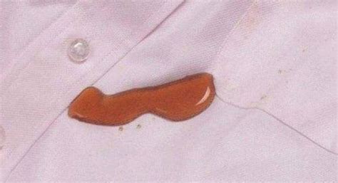 how to get dried gum out of clothes