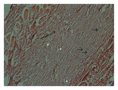 Histopathology Of Burn Wounds At Day 14 Stained With Hande 200x A