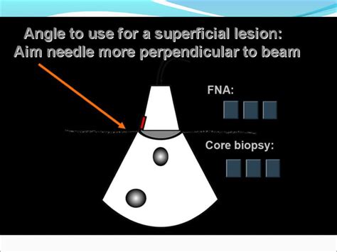 Usg Guided Fna Biopsy Ppt