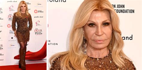 Donatella Versace Torna In Pubblico Dopo Una Incredibile