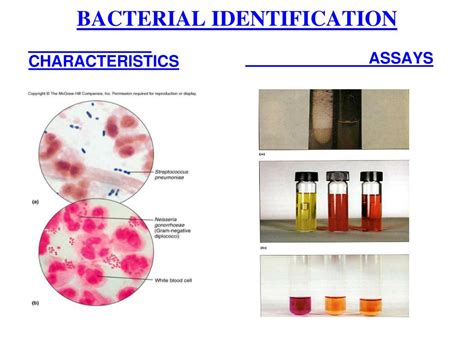 Ppt Bio General Microbiology Powerpoint Presentation Free