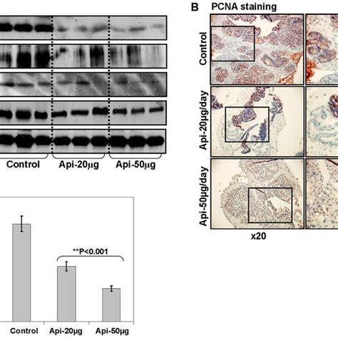 Effect Of Apigenin Intake On Proliferation And Nf B Regulated Genes In