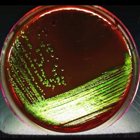 Emb Augar Inoculated With E Coli The Beauty Of Science Medical