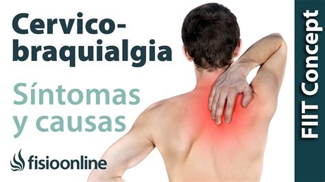 Qu Es La C Rvico Braquialgia O Dolor Cervical Irradiado Y Cu Les Son