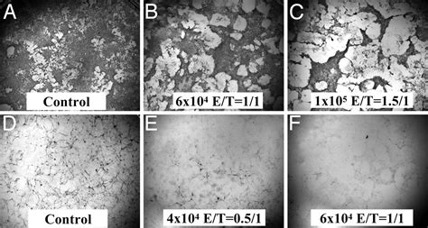 Neurotoxic Effects Of Polymorphonuclear Granulocytes On Hippocampal