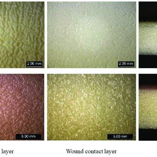 Photographs of the foam dressings from market. | Download Scientific Diagram