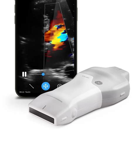 Vscan Air™ Wireless Handheld Ultrasound Ge Healthcare