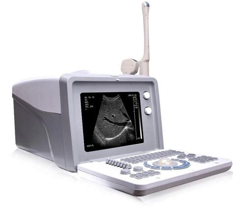 Pregnancy Scanner Ultrasound & Ultrasound Machine - Buy Best Ultrasound ...