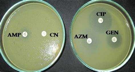 Antibiogram Profiles Of A Hydrophila Against Ampicillin