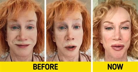 Kathy Griffin SHOCKS Fans After Showing The Result Of Her Lip Tattoo