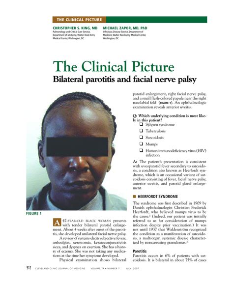 Bilateral Parotitis And Facial Nerve Palsy Cleveland Clinic Journal Of Medicine