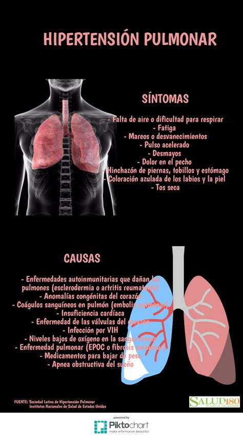 Hipertensión Pulmonar Enfermedad Catastrófica Y Mortal Salud180