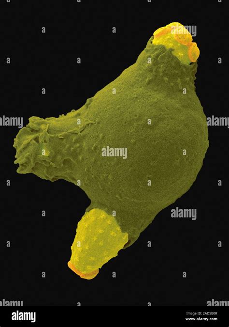 Human Neutrophil Phagocytosis Of The Yeast Candida Sp Coloured