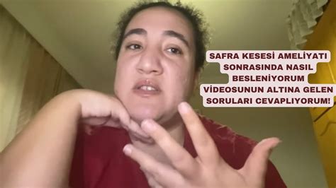 Safra Keses Amel Yati Sonrasinda Nasil Beslen Yorum V Deosunun Altina