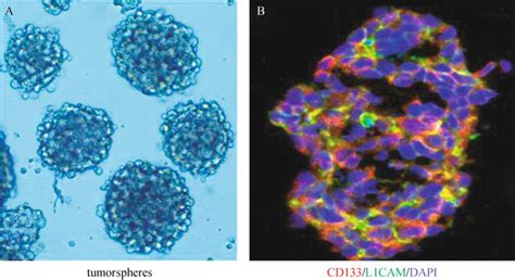 GBM Stem Cells GSCs Formed Tumorspheres And Expressed L1CAM And CD133