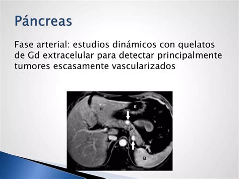 Medio De Contraste Gadolinio Ppt