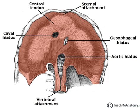 Diaphragmatic Hernia Teachmesurgery