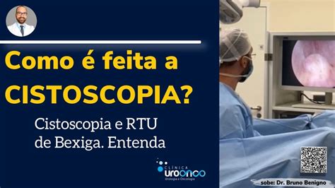 CISTOSCOPIA Biópsia e RTU de Bexiga Entenda o passo a passo em uma