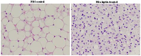 Histomorphology Of White Adipose Tissue From Pika Leptin Treated And