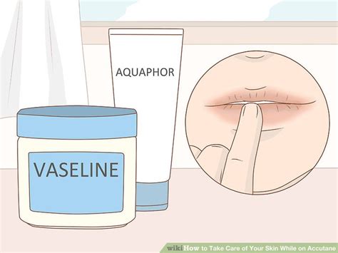 Ways To Take Care Of Your Skin While On Accutane Wikihow