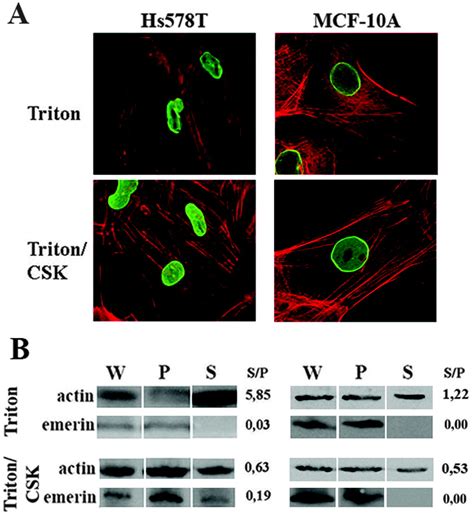 Differential Nuclear Shape Dynamics Of Invasive Andnon Invasive Breast