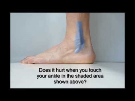 Lateral Malleolus