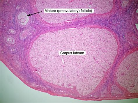 Corpus Luteum Histology Labeled