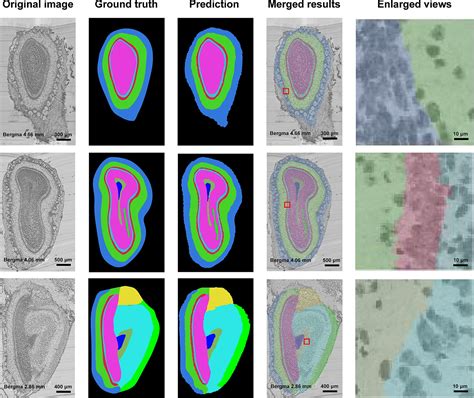 Frontiers An Interactive Image Segmentation Method For The Anatomical