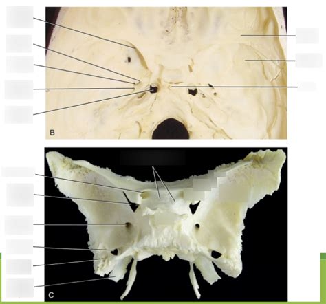 Sphenoid Anatomy Diagram Quizlet