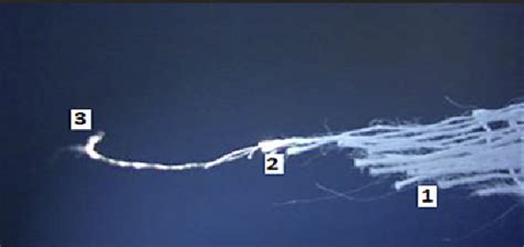 Figure 1 From Neurotrophic Keratopathy Treated With Topical Recombinant Human Nerve Growth