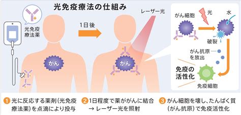 新しい選択肢、患者の希望に～「第5のがん治療」開発者・小林久隆氏に聞く～｜医療ニュース トピックス｜時事メディカル｜時事通信の医療ニュースサイト