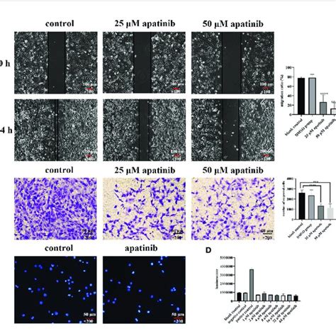 Apatinib Inhibits Proliferation And Affects Cell Cycle Of Malignant