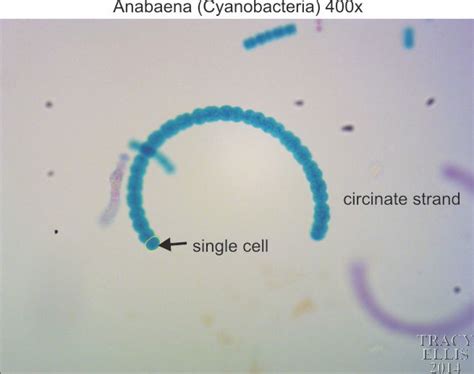 Anabaena Under Microscope Labeled