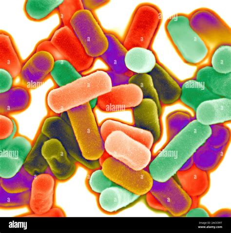 Gangrena Gaseosa Bacterias Clostridium Perfringens Color Micrografía