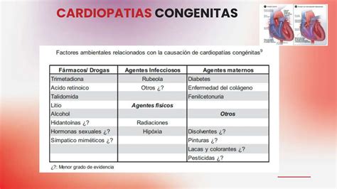 Cardiopatia Congenitas Clasificacion Presentacion Clinicas Y