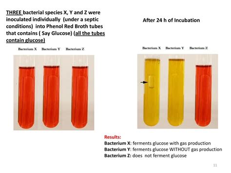 Phenol Red Broth