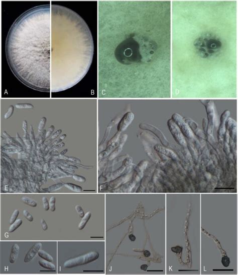 Colletotrichum Asianum Facesoffungi Number Fof Faces Of Fungi