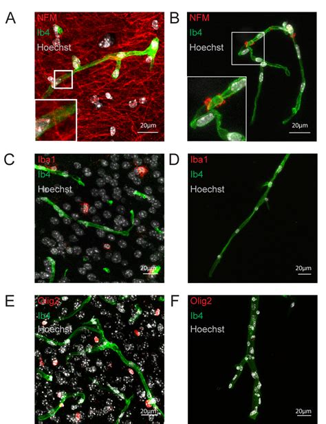 Purification Of Mouse Brain Vessels Protocol