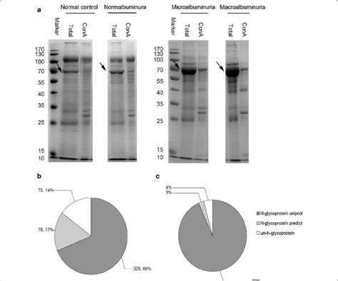 Qualitative And Quantitative Analysis Of Urinary Glycoproteome A