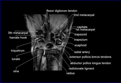 52 best images about MRI anatomy on Pinterest | Head and neck, Brain ...