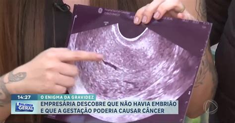 Gravidez Molar É Câncer