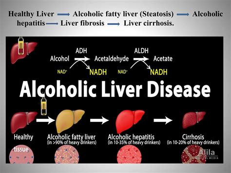 Pathophysiology Of Alcoholic Liver Diseasepptx