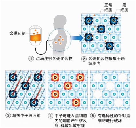 最快30分钟治愈癌症！中国首款“肿瘤核弹”完成中试，价格很亲民腾讯新闻