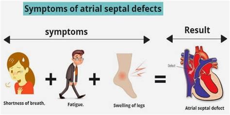 Atrial septal defect (Symptoms, Diagnosis, and Treatment) - Assignment ...