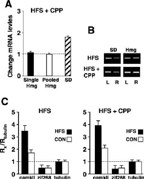 Enhanced Calcium Calmodulin Dependent Protein Kinase Camkii