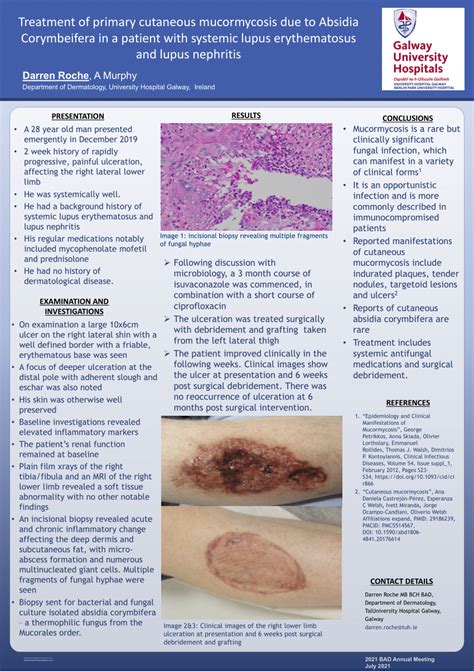 PDF Treatment Of Primary Cutaneous Mucormycosis Due To Absidia