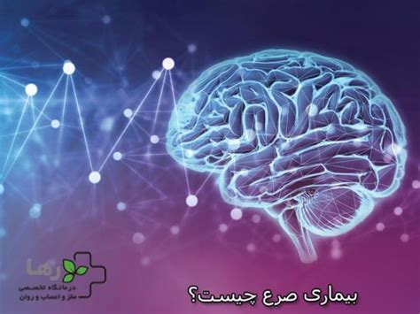 نوار مغزی برای تشخیص صرع کلینیک تخصصی مغز و اعصاب و روان