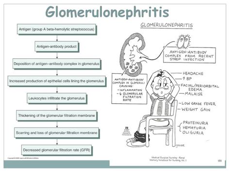 Ppt Introduction To Nephrology Acute And Chronic Glomerulonephritis Powerpoint Presentation