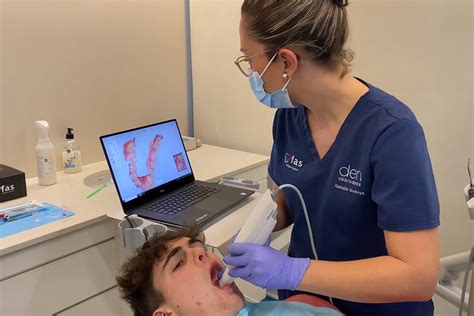 Escáner intraoral Qué es y para qué sirve